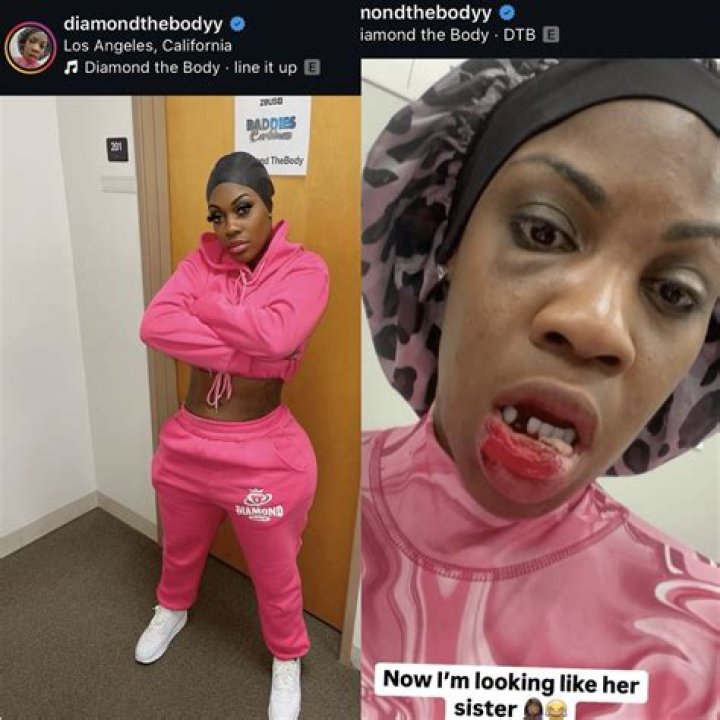 Diamond The Body (rapper)-Wiki, Age, Net Worth, Biography , Spotify, TikTok, Facebook, Facts and Family