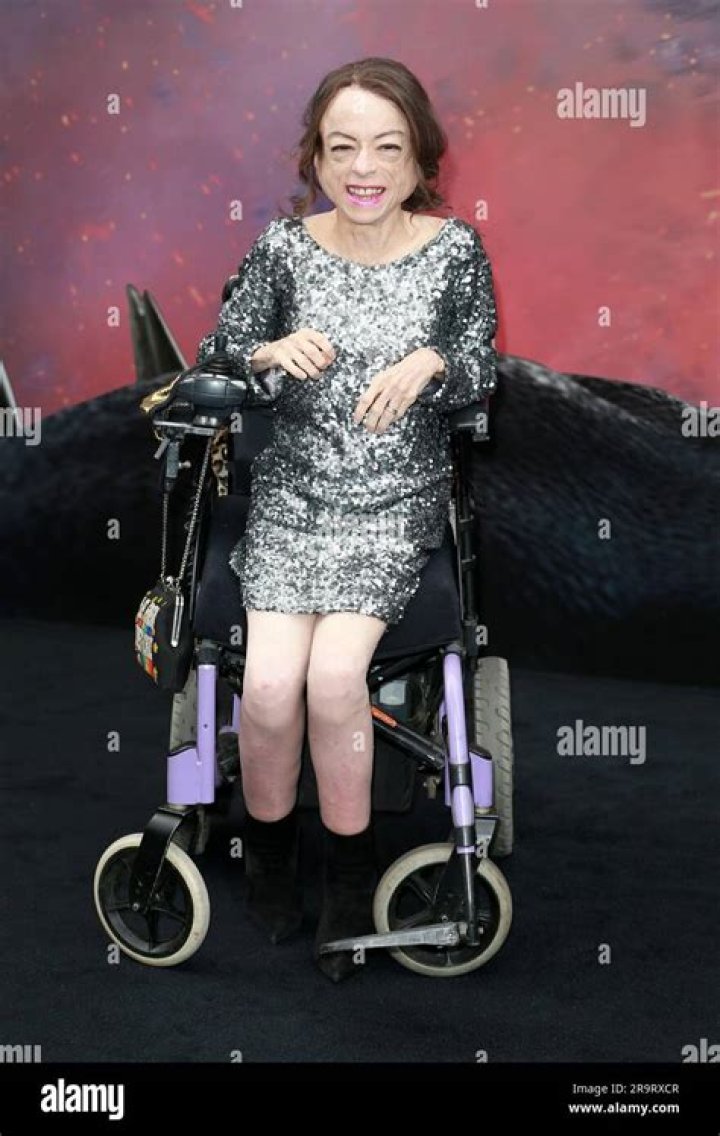 Liz Carr: TV Actress Detailed Bio, Age, Birthday, & Height Insights and more