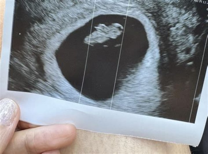 Oyo Boy Sotto - Bio, Age, siblings, height, Wiki, Facts and Family