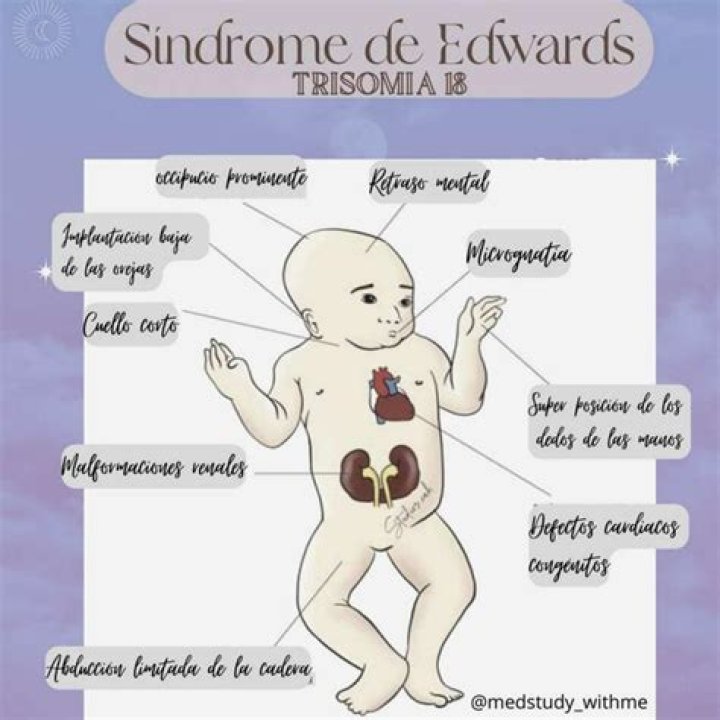 Trent Edwards - Bio, Age, net worth, height, Wiki, Facts and Family