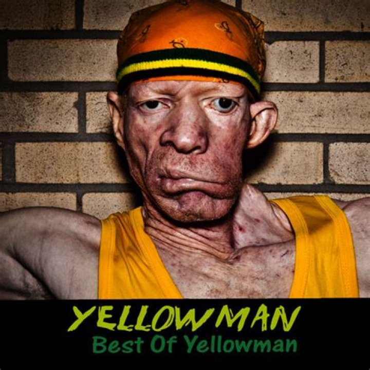 Yellowman - Bio, Age, net worth, Wiki, Facts and Family
